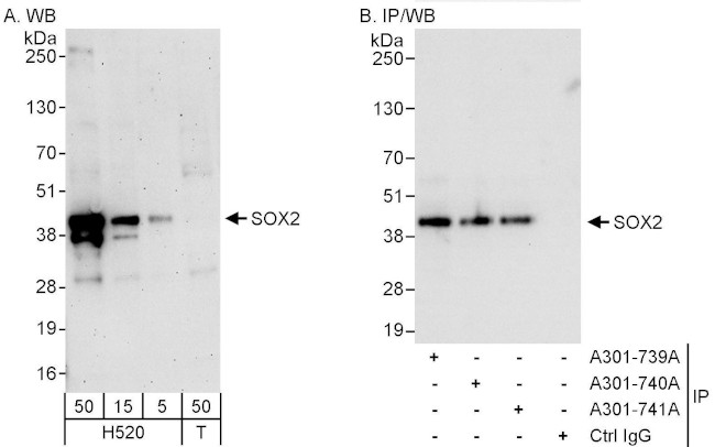 SOX2 Antibody in Western Blot (WB)