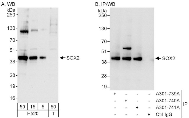 SOX2 Antibody in Western Blot (WB)