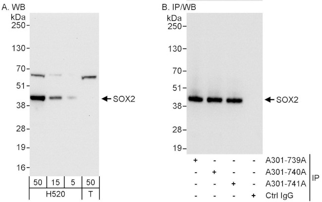 SOX2 Antibody in Western Blot (WB)