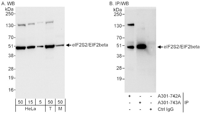 eIF2beta/EIF2S2 Antibody in Western Blot (WB)