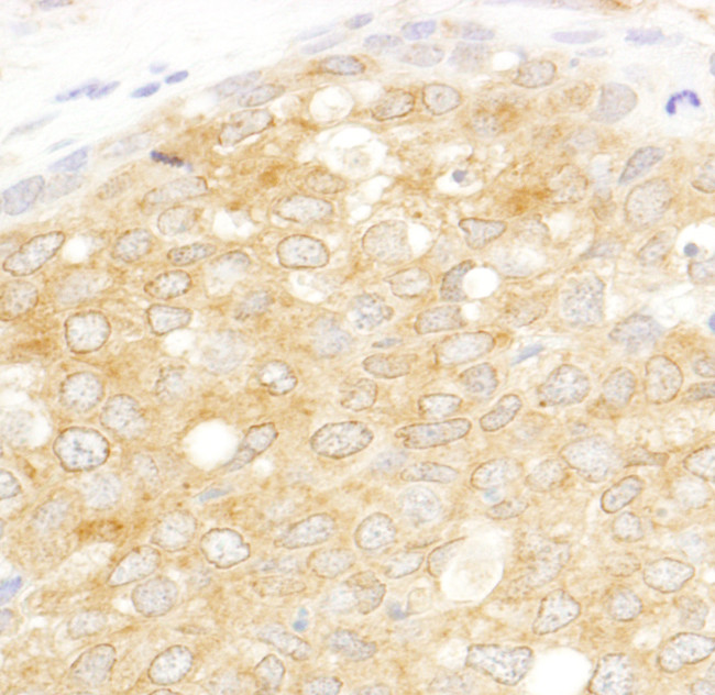 eIF2beta/EIF2S2 Antibody in Immunohistochemistry (Paraffin) (IHC (P))