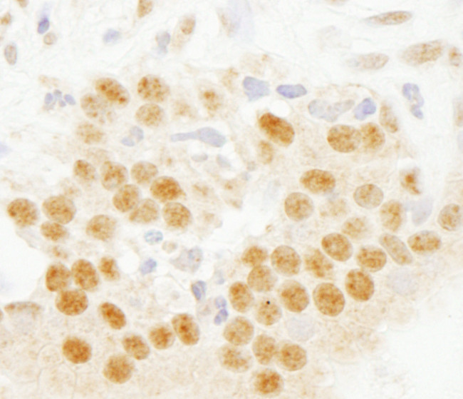 SET7 Antibody in Immunohistochemistry (Paraffin) (IHC (P))