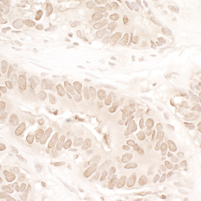 ASH1 Antibody in Immunohistochemistry (Paraffin) (IHC (P))