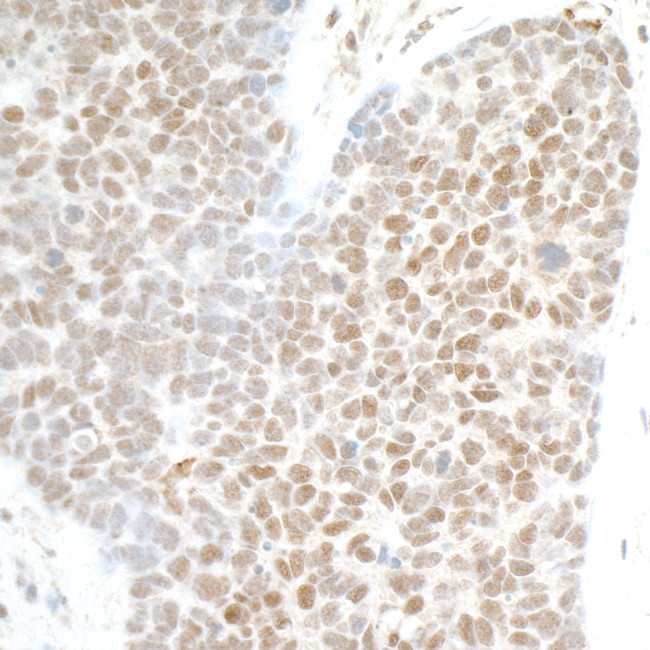 PHF8 Antibody in Immunohistochemistry (Paraffin) (IHC (P))