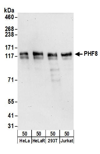 PHF8 Antibody in Western Blot (WB)