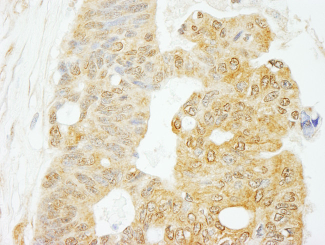 eIF4G1/eIF4GI Antibody in Immunohistochemistry (Paraffin) (IHC (P))