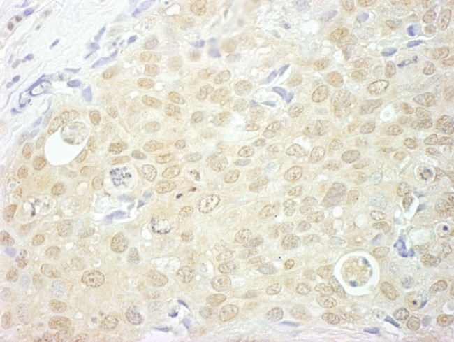 NCBP1/CBP80 Antibody in Immunohistochemistry (Paraffin) (IHC (P))