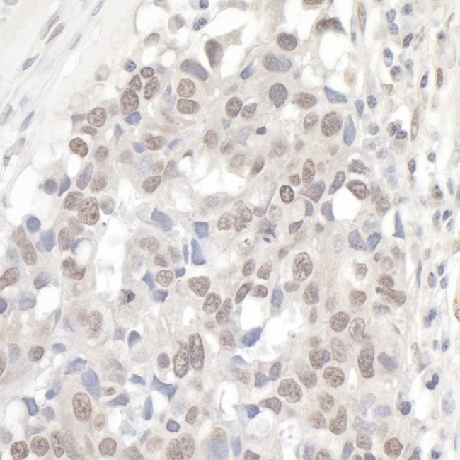 NCBP1/CBP80 Antibody in Immunohistochemistry (Paraffin) (IHC (P))