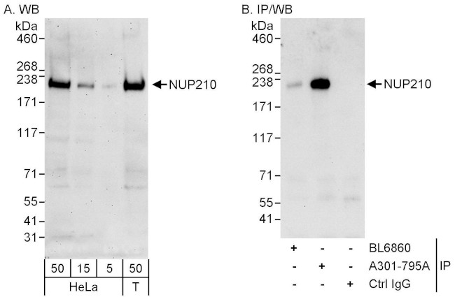 NUP210 Antibody in Western Blot (WB)