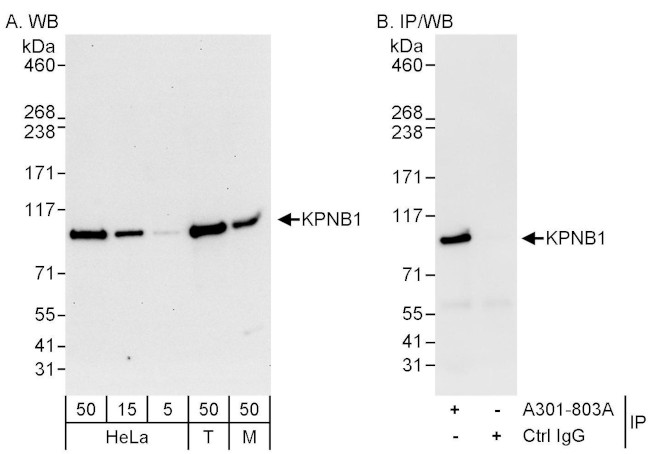 KPNB1 Antibody in Western Blot (WB)