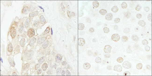 CDK2 Antibody in Immunohistochemistry (Paraffin) (IHC (P))