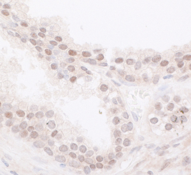 JARID1B Antibody in Immunohistochemistry (Paraffin) (IHC (P))