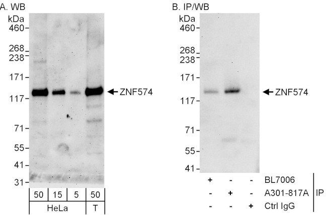 ZNF574 Antibody in Western Blot (WB)