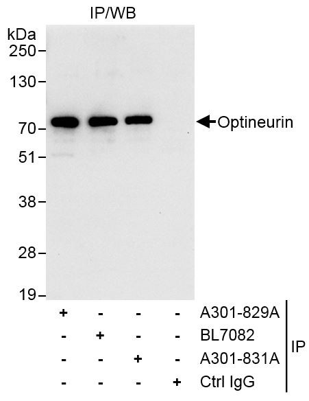 Optineurin Antibody in Immunoprecipitation (IP)