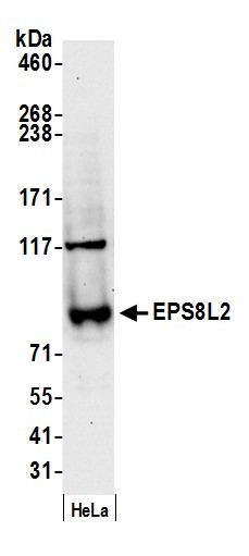 EPS8L2 Antibody in Western Blot (WB)