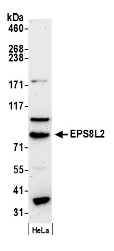 EPS8L2 Antibody in Western Blot (WB)