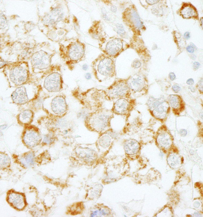 eIF4H Antibody in Immunohistochemistry (Paraffin) (IHC (P))