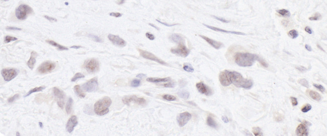 RPC2 Antibody in Immunohistochemistry (Paraffin) (IHC (P))