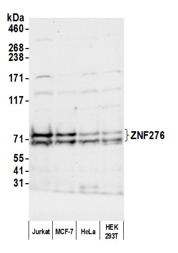 ZNF276 Antibody in Western Blot (WB)