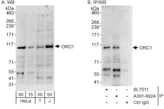 ORC1 Antibody in Western Blot (WB)