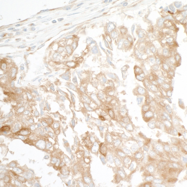 GEF-H1 Antibody in Immunohistochemistry (Paraffin) (IHC (P))