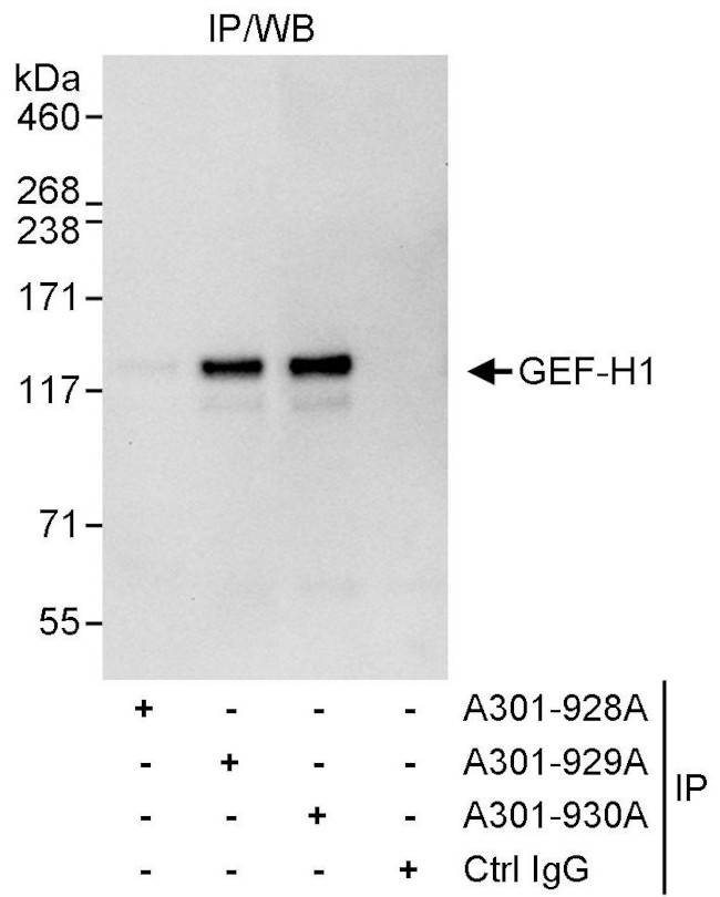 GEF-H1 Antibody in Immunoprecipitation (IP)