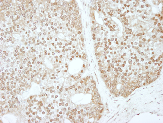 ZBTB40 Antibody in Immunohistochemistry (Paraffin) (IHC (P))