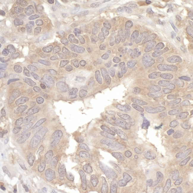 eIF2A Antibody in Immunohistochemistry (Paraffin) (IHC (P))