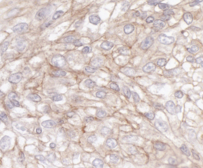 IQGAP1 Antibody in Immunohistochemistry (Paraffin) (IHC (P))