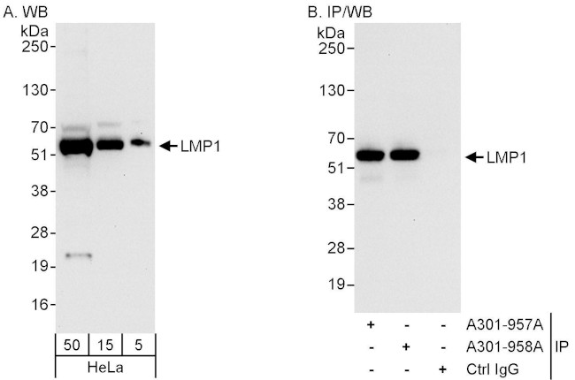 LMP1 Antibody in Western Blot (WB)