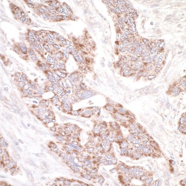 PDZ-GEF1 Antibody in Immunohistochemistry (Paraffin) (IHC (P))