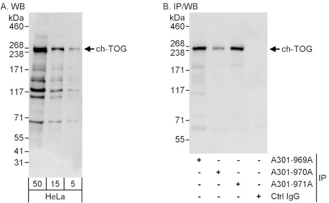 ch-TOG Antibody in Western Blot (WB)