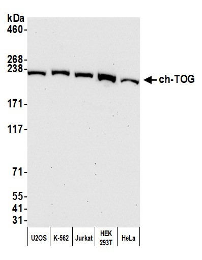 ch-TOG Antibody in Western Blot (WB)