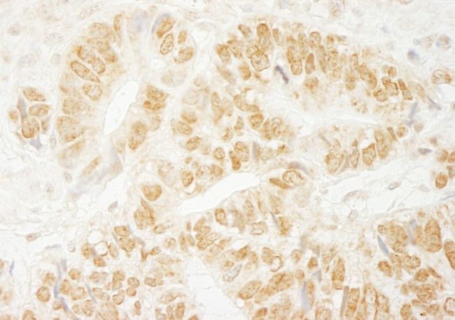 PA1 Antibody in Immunohistochemistry (Paraffin) (IHC (P))