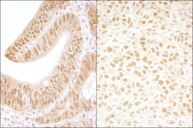 CKII beta Antibody in Immunohistochemistry (Paraffin) (IHC (P))