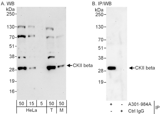 CKII beta Antibody in Western Blot (WB)