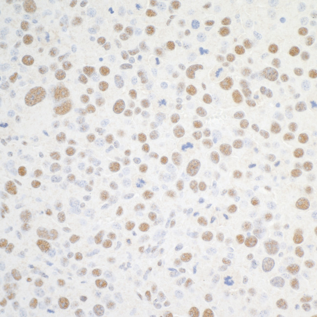 BRD4 Antibody in Immunohistochemistry (Paraffin) (IHC (P))