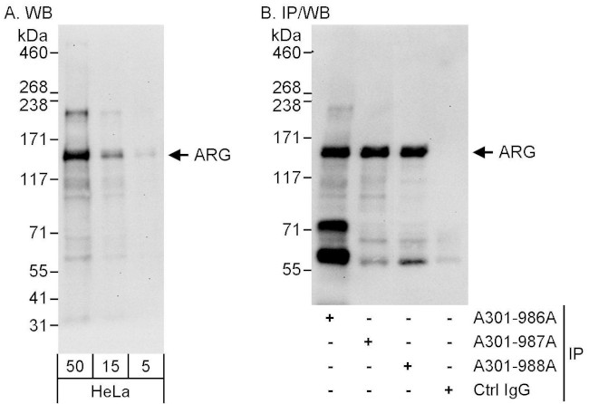 ARG Antibody in Western Blot (WB)