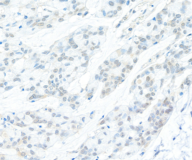 Cyclin C Antibody in Immunohistochemistry (Paraffin) (IHC (P))