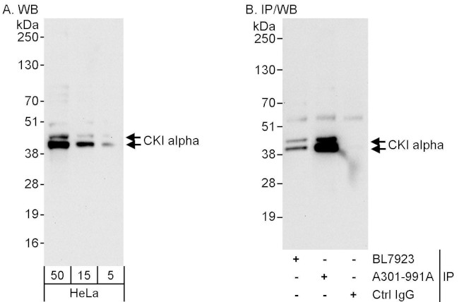 CKI alpha Antibody in Western Blot (WB)