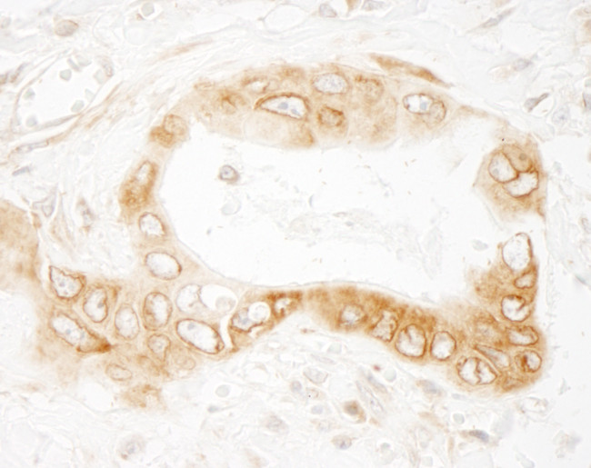 UVRAG Antibody in Immunohistochemistry (Paraffin) (IHC (P))