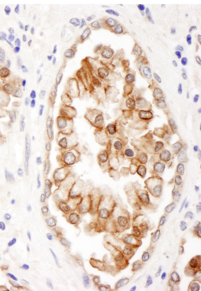 ABCB9 Antibody in Immunohistochemistry (Paraffin) (IHC (P))