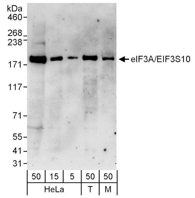 eIF3A/eIF3S10 Antibody in Western Blot (WB)