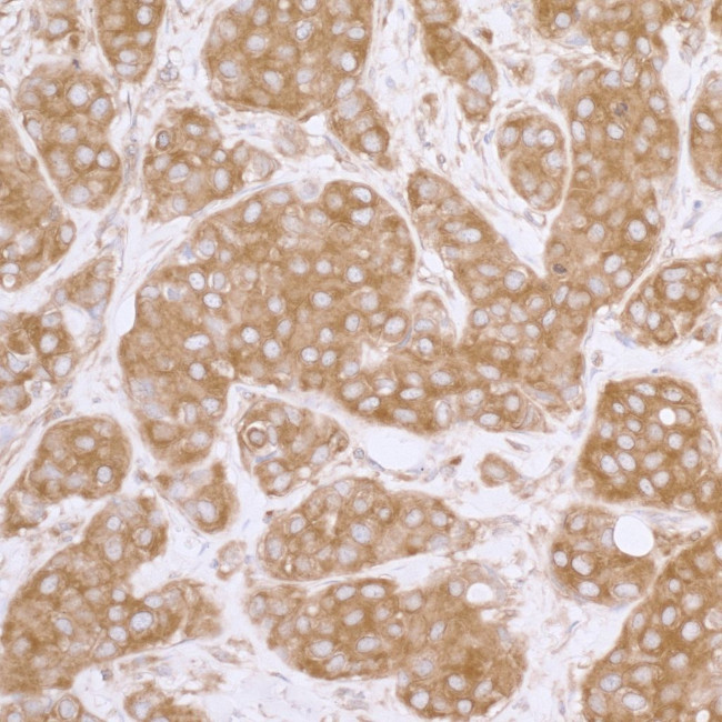 eIF3A/eIF3S10 Antibody in Immunohistochemistry (Paraffin) (IHC (P))