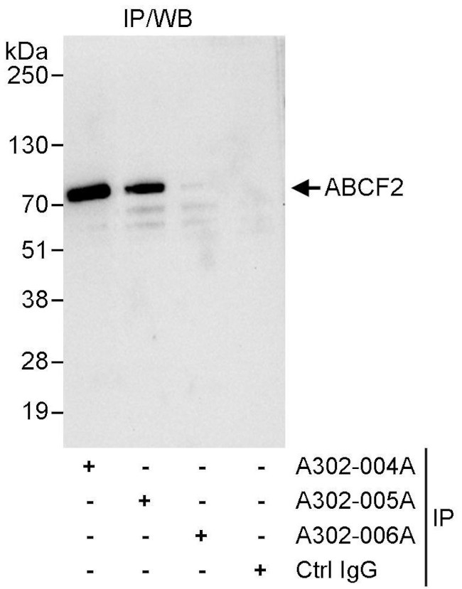 ABCF2 Antibody in Immunoprecipitation (IP)