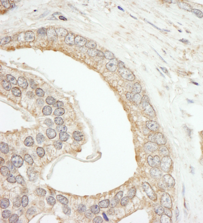 ABCF2 Antibody in Immunohistochemistry (Paraffin) (IHC (P))