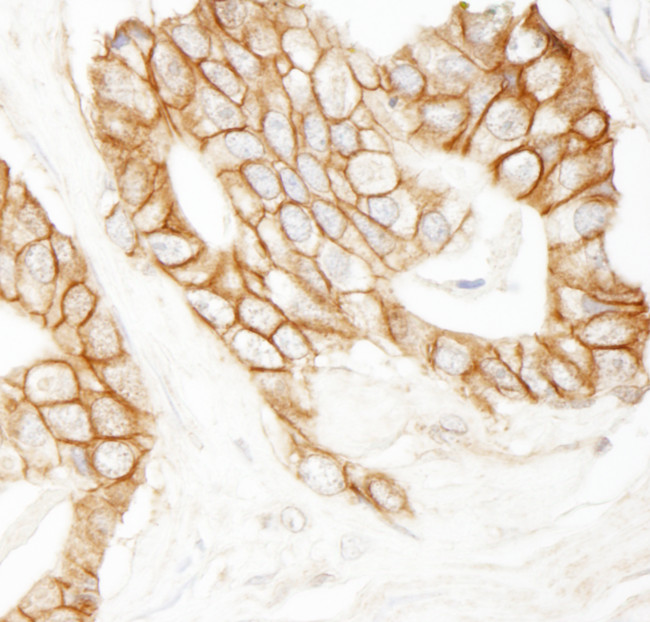 Beta-catenin Antibody in Immunohistochemistry (Paraffin) (IHC (P))