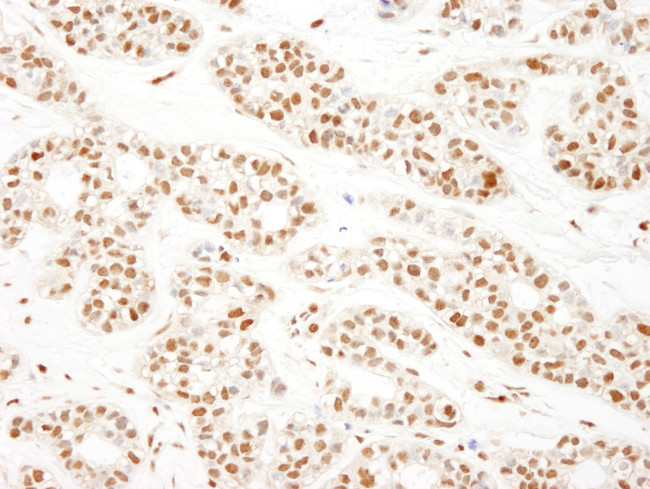 KSRP Antibody in Immunohistochemistry (Paraffin) (IHC (P))