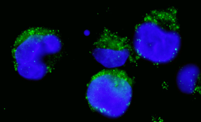 BCR Antibody in Immunocytochemistry (ICC/IF)