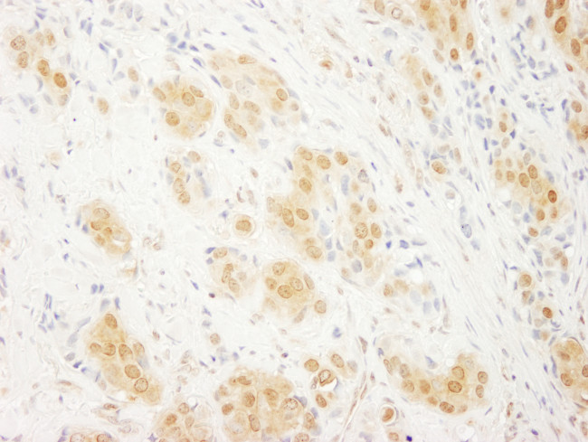 ERK2 Antibody in Immunohistochemistry (Paraffin) (IHC (P))